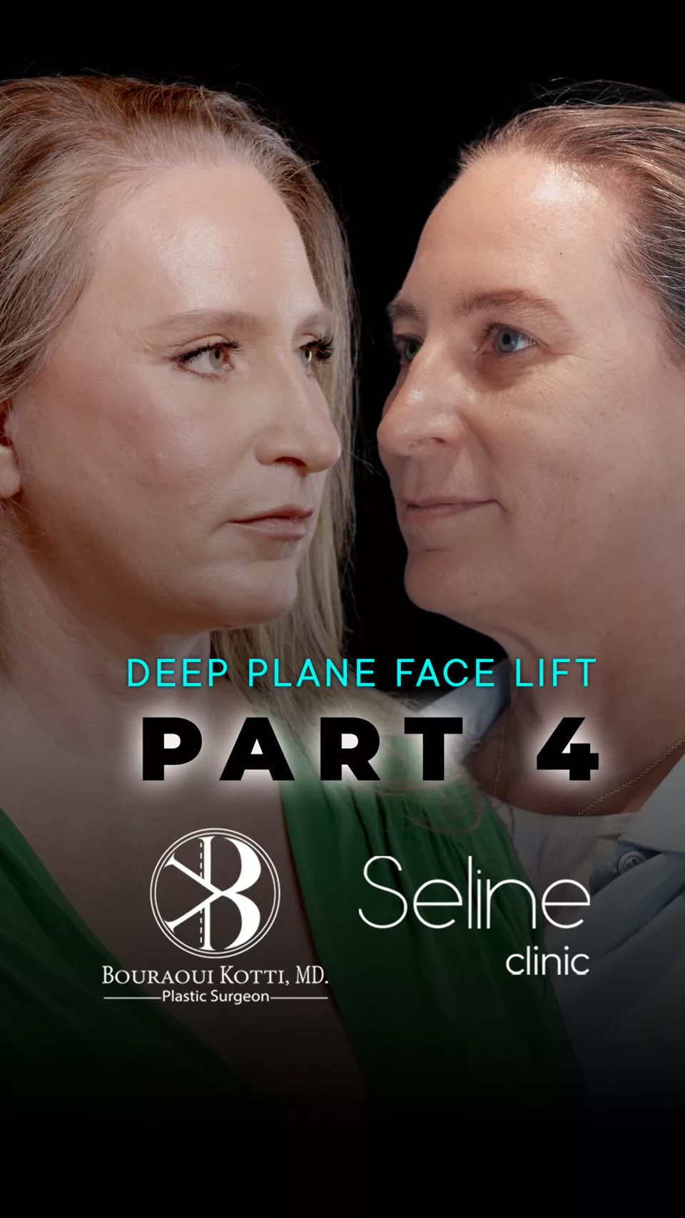 Facelift Dubai 2026 | Deep Plane Facelift Guide — Dr. Kotti — Plastic Surgery Insights by Dr. Bouraoui Kotti, Dubai