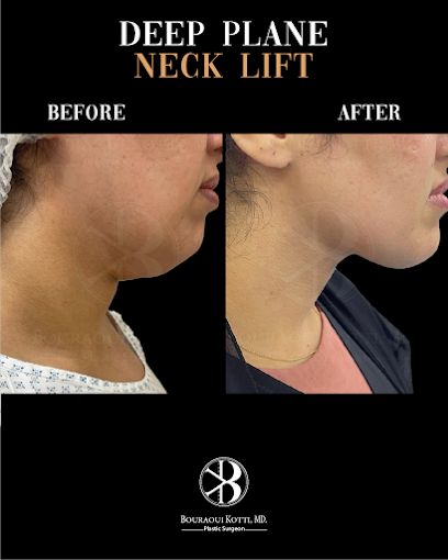 Deep plane neck lift