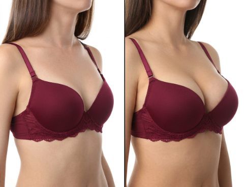 Top Breast Augmentation Doctor in Dubai | Dr. Kotti MD PHD EBOPRAS certified