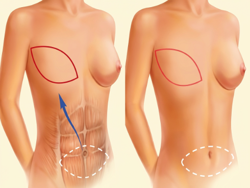 Reconstructive Surgery procedures in Dubai