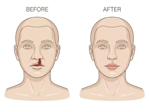 Reconstructive Surgery Dubai — Dr. Bouraoui Kotti